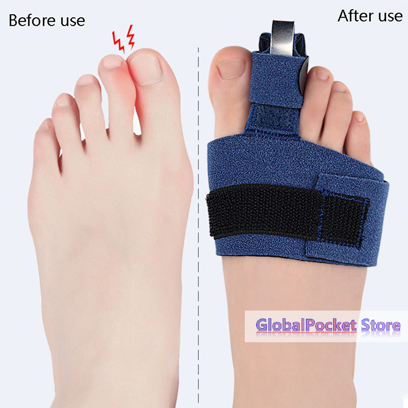 1Pcs Toe Corrector Toe Fractur - огляд і ціна Ankle Brace Sock